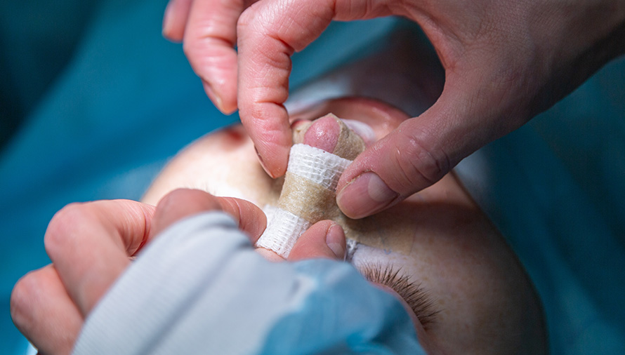 corrective rhinoplasty