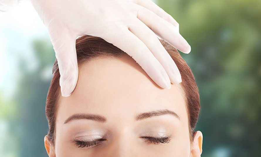 forheadlift browlift