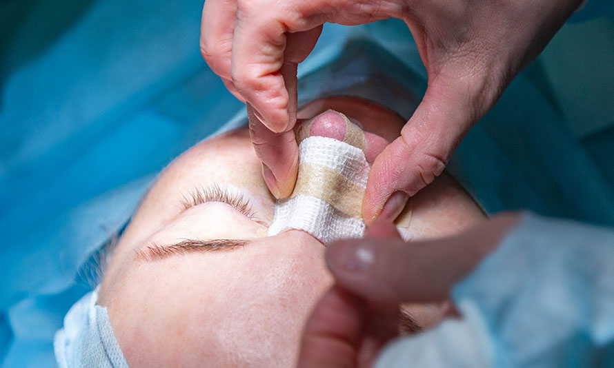 rhinoplasty still too wide